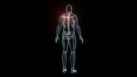 3D Rendering of a Medical Animation of the Collarbone. X-ray of the Collarbone. Stock Footage 239838655