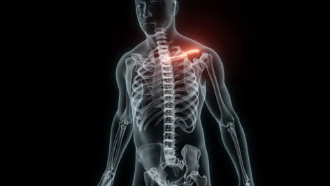 3D Rendering of a Medical Animation of the Collarbone. X-ray of the Collarbone. Stock Footage 239839635