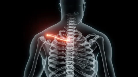 3D Rendering of a Medical Animation of the Collarbone. X-ray of the Collarbone. Stock Footage 239840515