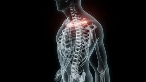 3D Rendering of a Medical Animation of the Collarbone. X-ray of the Collarbone. Stock Footage 239841442