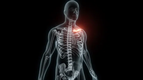 3D Rendering of a Medical Animation of the Collarbone. X-ray of the Collarbone. Stock Footage 239844305