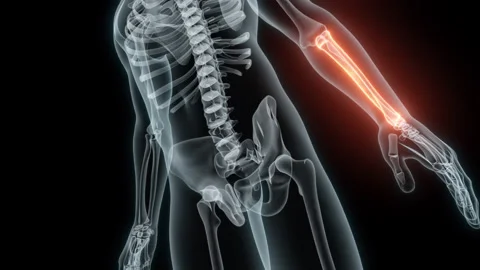3D rendering of a medical animation of a Forearm. X-ray of a human Forearm. Stock Footage 239634776