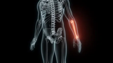 3D rendering of a medical animation of a Forearm. X-ray of a human Forearm. Stock Footage 239636113
