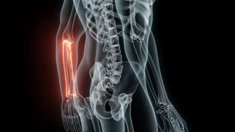 3D rendering of a medical animation of a Forearm. X-ray of a human Forearm. Stock Footage 239641937