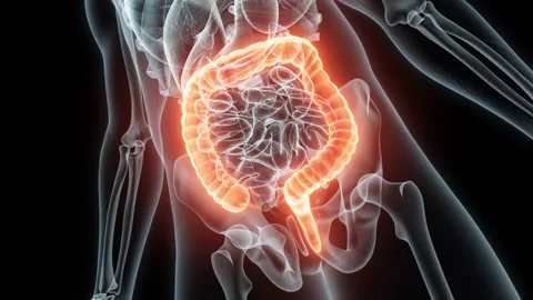 3D rendering Medical Animation of a Human Intestine .X-ray of a Brain Video stock 235891127