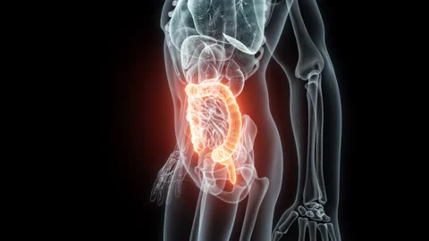 3D rendering Medical Animation of a Human Intestine .X-ray of a Brain Video stock 235895340