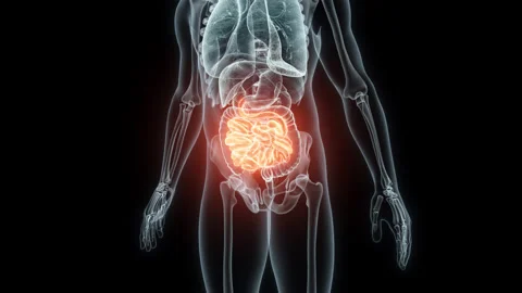 3D rendering Medical Animation of a Human Small Intestine .X-ray of a Small Video stock 236576630