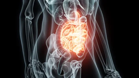 3D rendering Medical Animation of a Human Small Intestine .X-ray of a Small Stock Footage 236578570