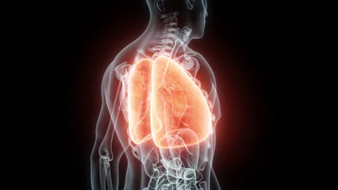 3D rendering Medical Animation of a Human Lungs.X-ray of a Lungs Stock Footage 237097025