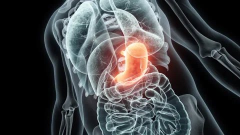 3D rendering Medical Animation of a Human Stomach.X-ray of a Stomach Stock Footage 237802598