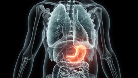 3D rendering Medical Animation of a Human Stomach.X-ray of a Stomach Stock Footage 237804331