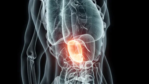 3D rendering Medical Animation of a Human Stomach.X-ray of a Stomach Stock Footage 237804951