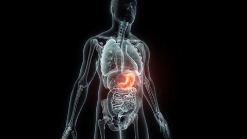 3D rendering Medical Animation of a Human Stomach.X-ray of a Stomach Stock Footage 237805172