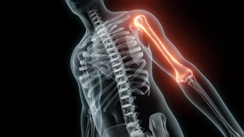 3D rendering of a medical animation of a Humerus. X-ray of a human Humerus. Stock Footage 239647582