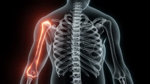 3D rendering of a medical animation of a Humerus. X-ray of a human Humerus. Stock Footage 239650547