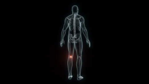 3D Rendering of a Medical Animation of the Knee. X-ray of the Knee. Stock Footage 239851216