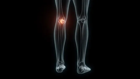3D Rendering of a Medical Animation of the Knee. X-ray of the Knee. Stock Footage 239853290