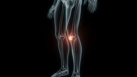 3D Rendering of a Medical Animation of the Knee. X-ray of the Knee. Stock Footage 239854034