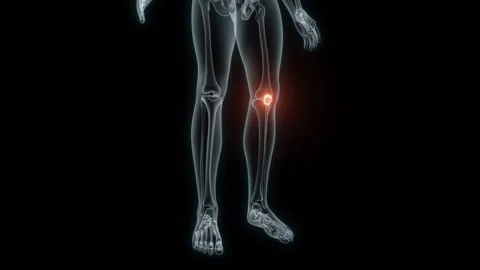 3D Rendering of a Medical Animation of the Knee. X-ray of the Knee. Stock Footage 239854669