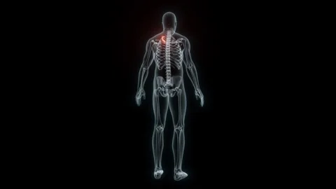 3D rendering of a medical animation of a rib. X-ray of a human rib. Stock Footage 234050823