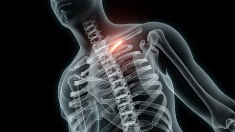 3D rendering of a medical animation of a rib. X-ray of a human rib. Stock Footage 234051525