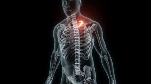 3D rendering of a medical animation of a rib. X-ray of a human rib. Stock Footage 234052486