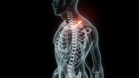 3D rendering of a medical animation of a rib. X-ray of a human rib. Stock Footage 234053752