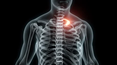 3D rendering of a medical animation of a rib. X-ray of a human rib. Stock Footage 234055204