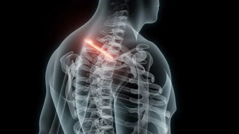 3D rendering of a medical animation of a rib. X-ray of a human rib. Stock Footage 234055478