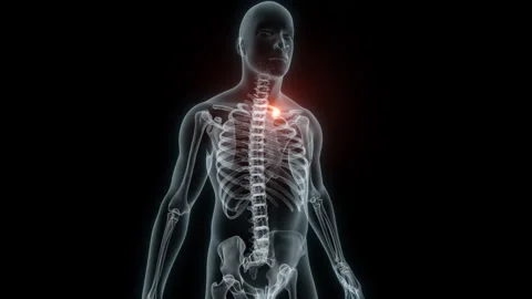 3D rendering of a medical animation of a rib. X-ray of a human rib. Stock Footage 234056689