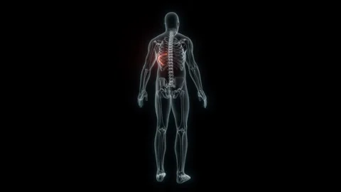 3D rendering of a medical animation of a rib. X-ray of a human rib. Stock Footage 239537129
