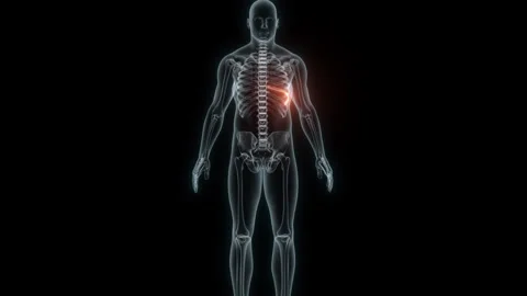 3D rendering of a medical animation of a rib. X-ray of a human rib. Stock Footage 239543949