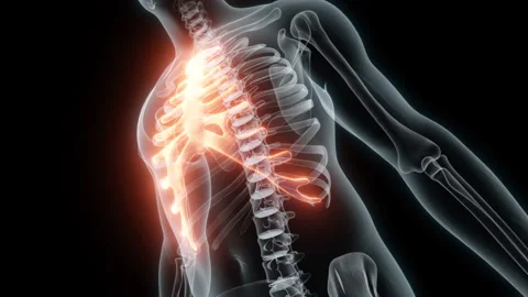3D Rendering of a Medical Animation of the Rib cage. X-ray of the Rib cage. Stock Footage 239845727