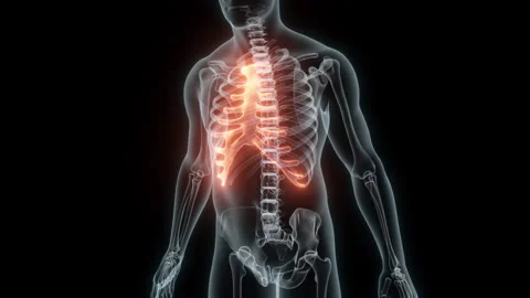 3D Rendering of a Medical Animation of the Rib cage. X-ray of the Rib cage. Stock Footage 239847160