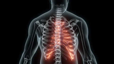 3D Rendering of a Medical Animation of the Rib cage. X-ray of the Rib cage. Stock Footage 239847857
