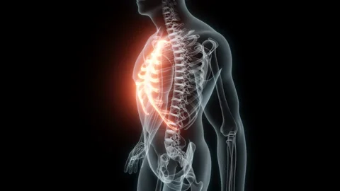3D Rendering of a Medical Animation of the Rib cage. X-ray of the Rib cage. Stock Footage 239848584