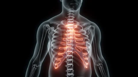 3D Rendering of a Medical Animation of the Rib cage. X-ray of the Rib cage. Stock Footage 239849503