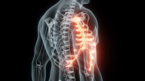 3D Rendering of a Medical Animation of the Rib cage. X-ray of the Rib cage. Stock Footage 239850288