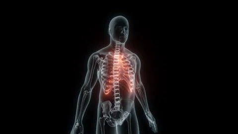 3D Rendering of a Medical Animation of the Rib cage. X-ray of the Rib cage. Stock Footage 239850650
