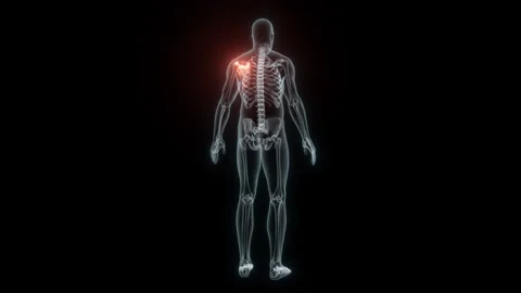 3D Rendering of a Medical Animation of the Scapula. X-ray of the Scapula. Stock Footage 239832389