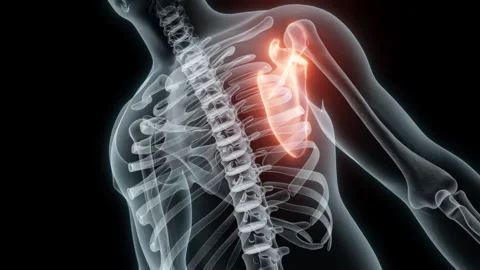 3D Rendering of a Medical Animation of the Scapula. X-ray of the Scapula. Stock Footage 239833111