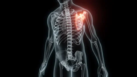 3D Rendering of a Medical Animation of the Scapula. X-ray of the Scapula. Stock Footage 239833826