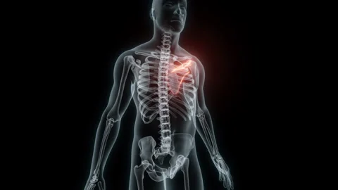3D Rendering of a Medical Animation of the Scapula. X-ray of the Scapula. Stock Footage 239837931