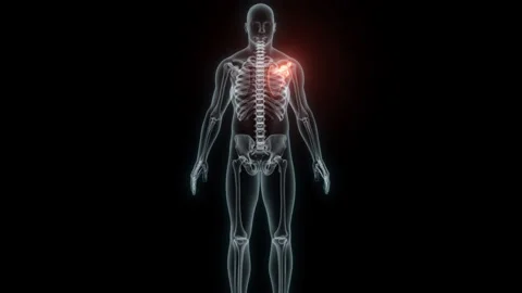 3D Rendering of a Medical Animation of the Scapula. X-ray of the Scapula. Stock Footage 239837968