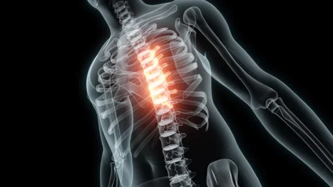 3D Rendering of a Medical Animation of the Spine ,Thoracic Vertebrae. X-ray of Stock Footage 239726464