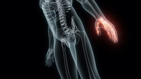 3D Rendering of a Medical Animation of the Wrist. X-ray of the Wrist. Stock Footage 240822367