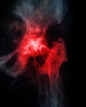 3D rendering Pelvic bone and hip joint 3D isolated on black background. Illustrazione stock