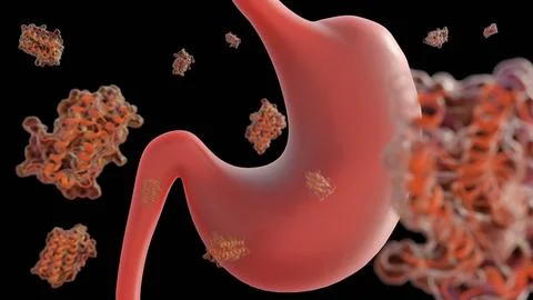 A 3d rendering of scattered leptin molecules and human stomach. Stock Illustration