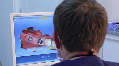 3D scan dental examination Stock Footage 61155854