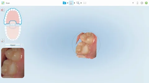 3D scan of teeth Video stock 129324249